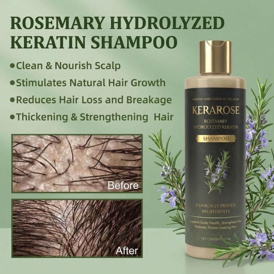 Kerarose Rosemary Shampoo For Hair Growth (Buy 1 Get 1 Free 🔥🔥)